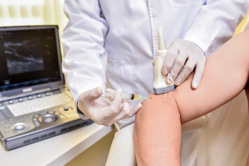 Ultrasound-guided platelet-rich plasma injection of the elbow