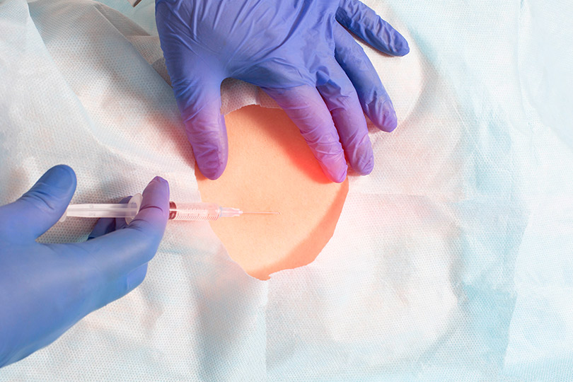 A person wearing blue gloves, likely preparing for a procedure related to interventional pain management.