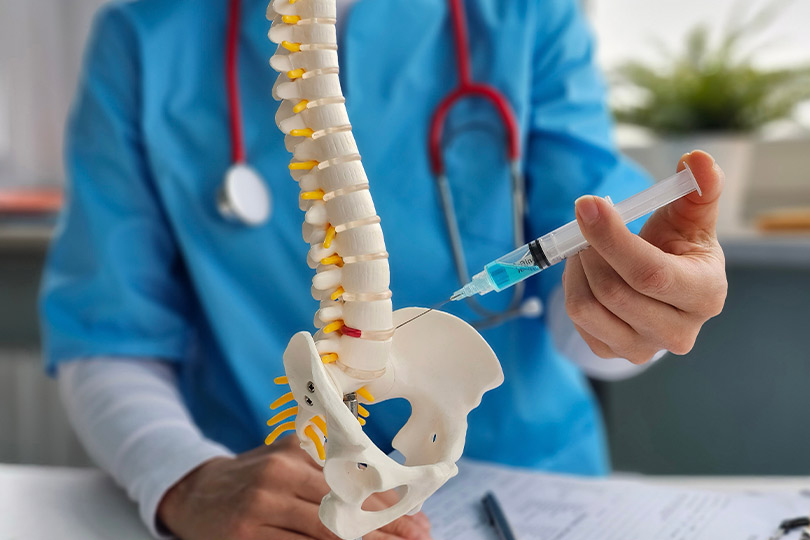 A physician displays a syringe and a spine model, addressing the effects of steroid injections on back pain relief.