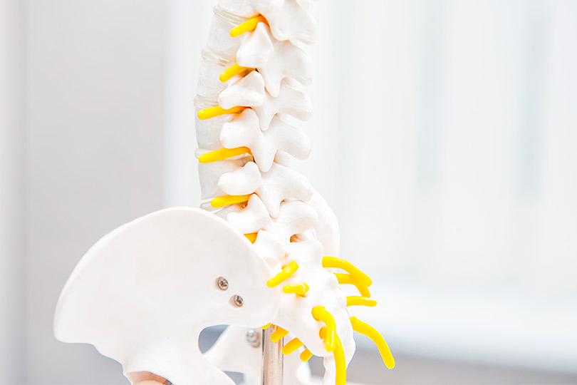Anatomical spine model with yellow and white components, highlighting key areas for back pain relief strategies in McAllen.