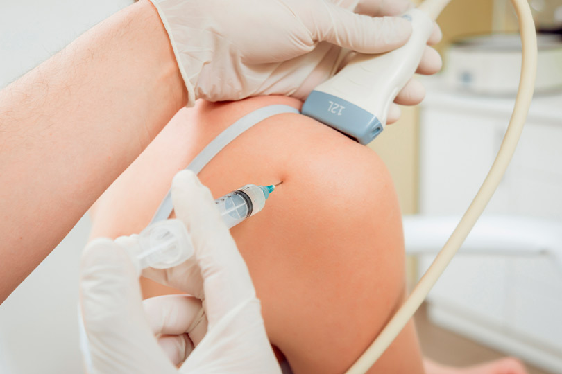 nerve block: A person receiving an injection in the arm as part of their rheumatoid arthritis treatment.
