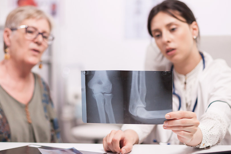 A woman studies an X-ray image of a knee, assessing it in the context of rheumatoid arthritis treatment options.