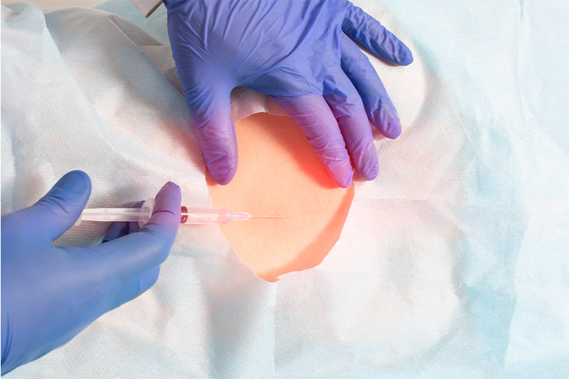 A person wearing blue gloves holds a syringe, suggesting a medical procedure related to neck pain relief.