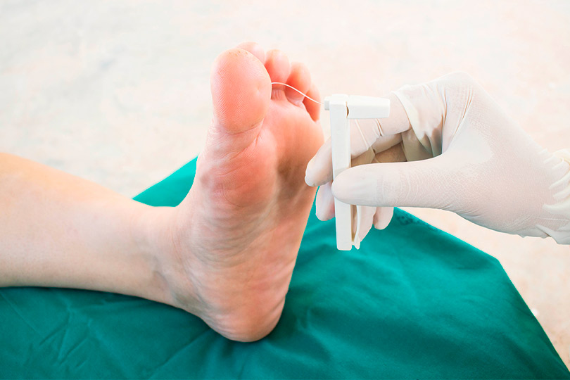 A doctor examines a patient's foot, focusing on diabetic nerve pain treatment options in South Texas.
